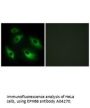 Anti-EPHB6/Eph Receptor B6 Antibody