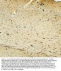 Anti-FACL4/ACSL4 Antibody Picoband®