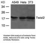 Anti-Twist2 Antibody