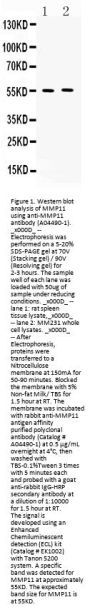 Anti-MMP11 Antibody Picoband®