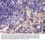 Anti-MMP11 Antibody Picoband®