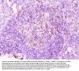 Anti-MMP11 Antibody Picoband®