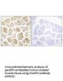 Anti-MAPK3 MAPKAPK3 Antibody