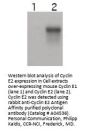 Anti-Cyclin E2 CCNE2 Antibody