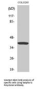 Anti-G alpha t1 Antibody