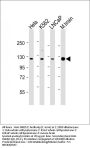 Anti-JMJD2C Antibody (C-term)