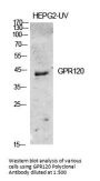 Anti-GPR120 FFAR4 Antibody