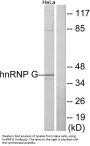 Anti-hnRNP G RBMX Antibody