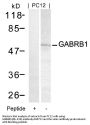 Anti-GABRB1(Ab-434) Antibody