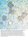 Anti-Annexin A3/ANXA3 Antibody PicobandÂ®