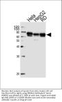 Anti-PRKAG3 Antibody (C-term)