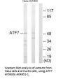 Anti-ATF7 Antibody