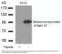 Anti-Melanoma-associated antigen D1 Maged1 Antibody