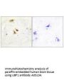 Anti-UBF1 UBTF Antibody