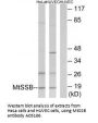 Anti-MtSSB SSBP1 Antibody