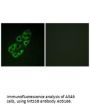 Anti-MtSSB SSBP1 Antibody