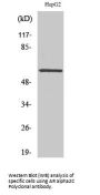 Anti-AR alpha2C ADRA2C Antibody