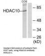 Anti-Histone deacetylase 10 HDAC10 Antibody