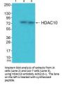 Anti-Histone deacetylase 10 HDAC10 Antibody