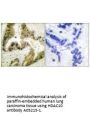 Anti-Histone deacetylase 10 HDAC10 Antibody