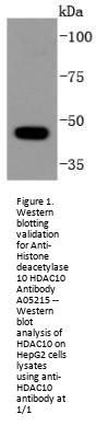 Anti-Histone deacetylase 10 HDAC10 Antibody