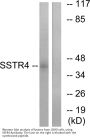 Anti-SSTR4/Somatostatin Receptor 4 Antibody