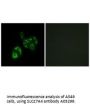 Anti-SLC27A4/Fatp4 Antibody