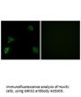 Anti-GRID2 Antibody