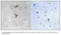 Anti-KCNT1 Antibody