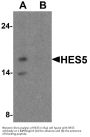 Anti-Transcription factor HES-5 HES5 Antibody