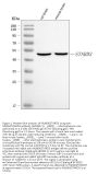 Anti-MLN64/STARD3 Antibody Picoband®