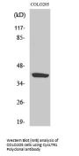 Anti-CysLTR1/Cyslt1 Antibody