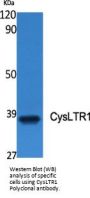 Anti-CysLTR1/Cyslt1 Antibody