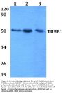 Anti-Tubulin beta-1 chain TUBB1 Antibody
