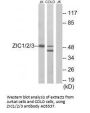 Anti-ZIC1/2/3 Antibody