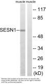 Anti-SESN1/Pa26 Antibody