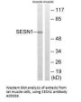Anti-SESN1/Pa26 Antibody