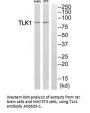 Anti-TLK1 Antibody