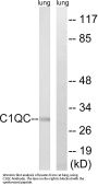 Anti-C1QC/Complement Component C1Qc Antibody