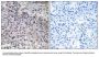 Anti-C1QC/Complement Component C1Qc Antibody