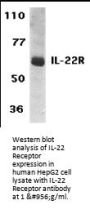 Anti-IL-22 Receptor IL22RA1 Antibody