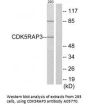 Anti-CDK5RAP3 Antibody