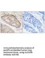 Anti-ALS2CR8 CARF Antibody