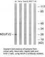 Anti-NDUFV2 Antibody