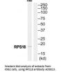 Anti-RPS18/Ribosomal Protein S18 Antibody