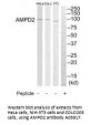 Anti-AMP deaminase 2 AMPD2 Antibody