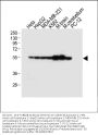 Anti-TUBB2B Antibody (N-term)
