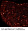 Anti-P2X3 P2RX3 Antibody