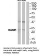 Anti-Ras-related protein Rab-31 RAB31 Antibody