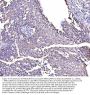 Anti-MIRO1/RHOT1 Antibody PicobandÂ®